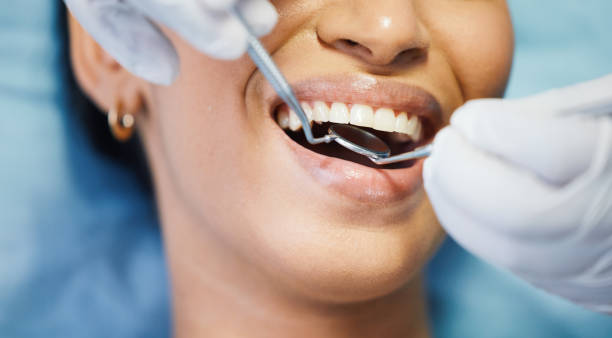 Best Emergency Dentist for Lost Fillings or Crowns in Pablo, MT